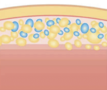 脂肪冷却の仕組み：代謝による排出