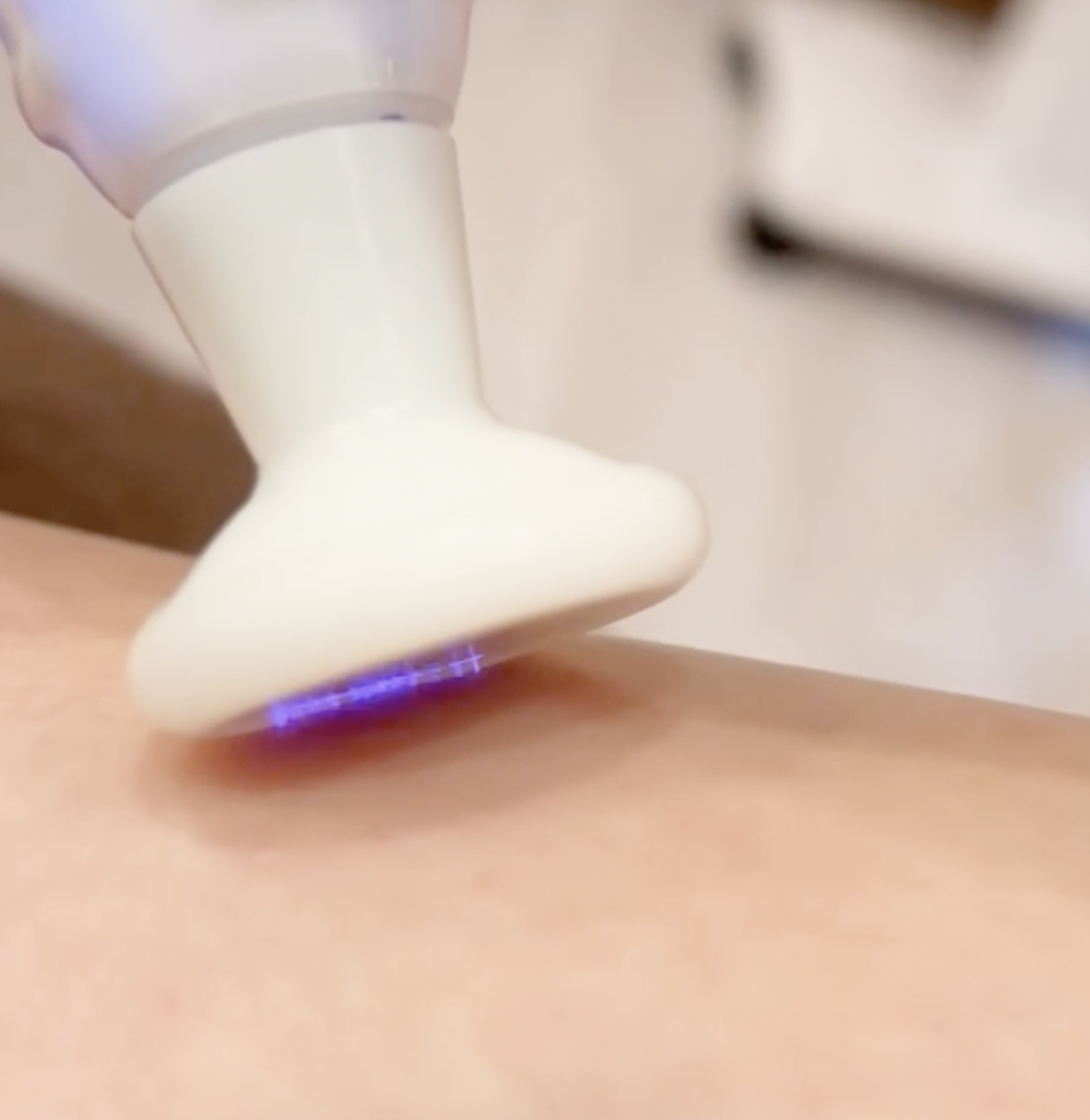 プラズマシャワー