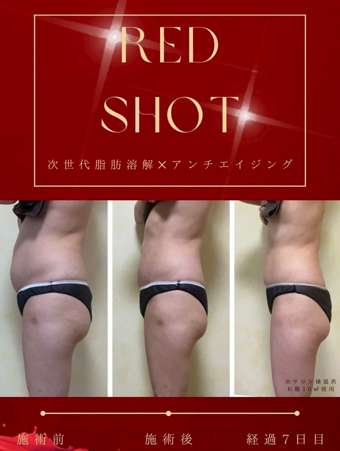 RED SHOT製品イメージ