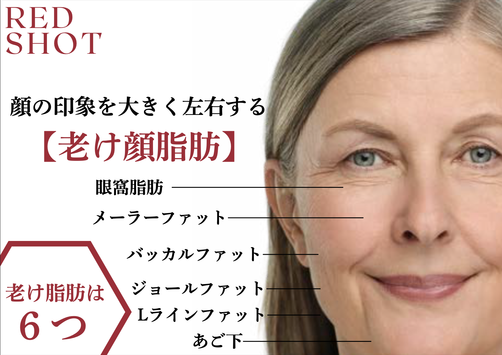 RED SHOT フェイシャル解説図